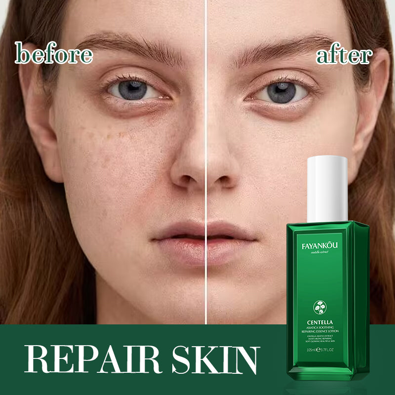 FAYANKOU Centella Soothing Repair Essence Lotion 105ml