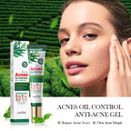 SADOER Tea Tree Acne Control Oil Gel 20g