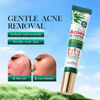 SADOER Tea Tree Acne Control Oil Gel 20g