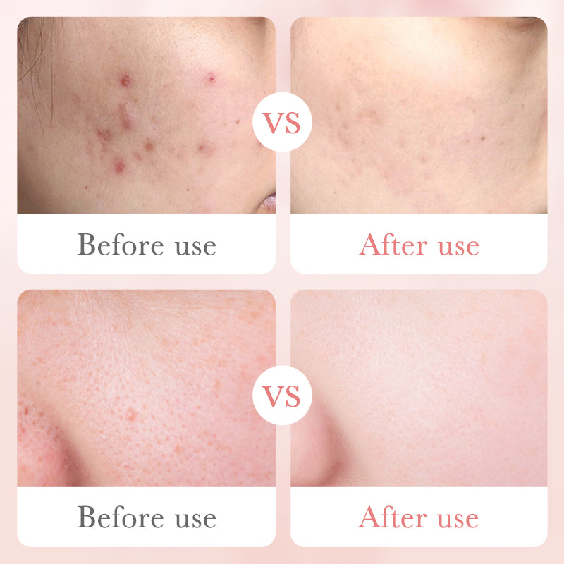 BIOAOUA Rose Hyaluronic Acid Moisturizing 6-Piece Set 20g+100g+30ml+100ml+100ml+50g