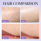 SADOER Hair Growth Inhibitor Spray 30ml