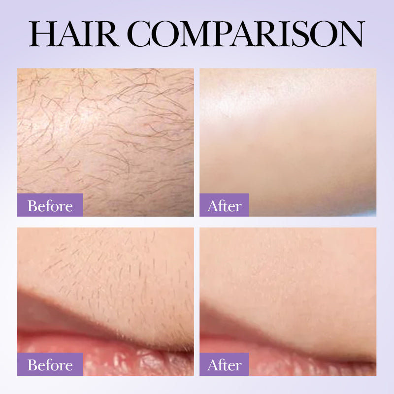 SADOER Hair Growth Inhibitor Spray 30ml