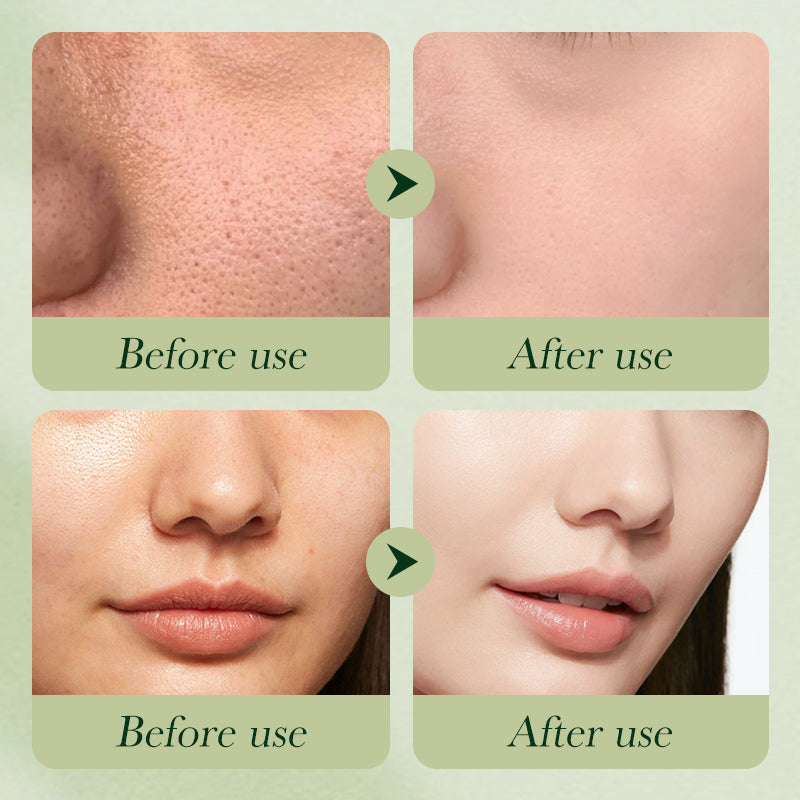 SADOER Avocado Series Moisturizing 6-Piece Set 100g+130ml+100ml+50g+30ml+20g