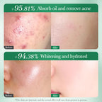 SADOER Salicylic Acid Niacinamide Tea Tree Whitening Acne Cleanser 100g