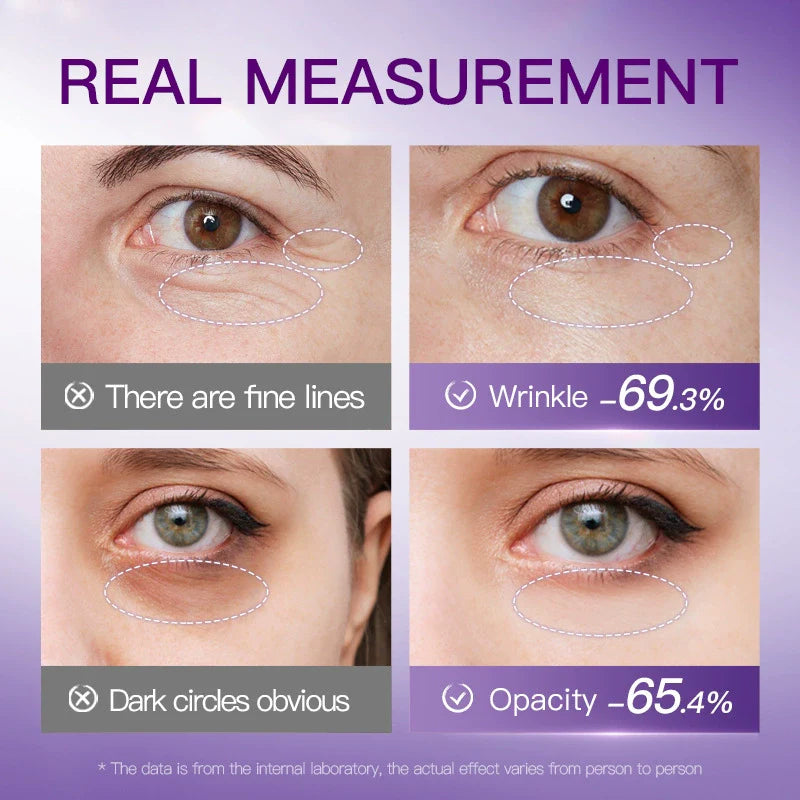 BIOAOUA Collagen Snake Venom Peptide Anti-Wrinkle Freeze-dried Eye Mask