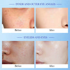 SADOER High Moisturizing Vitamin E Cream Hydrates, moisturizes, rejuvenates and nourishes the skin