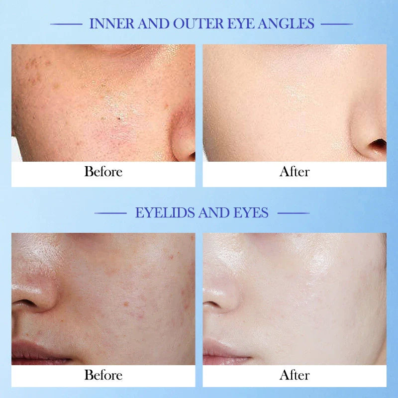 SADOER High Moisturizing Vitamin E Cream Hydrates, moisturizes, rejuvenates and nourishes the skin